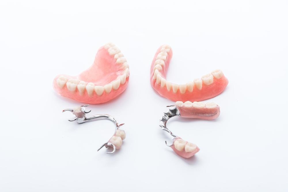 All Types of Removable Dentures